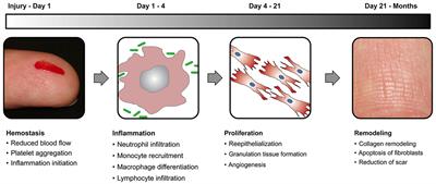 Surface Engineered Metal-Organic Frameworks (MOFs) Based Novel Hybrid Systems for Effective Wound Healing: A Review of Recent Developments